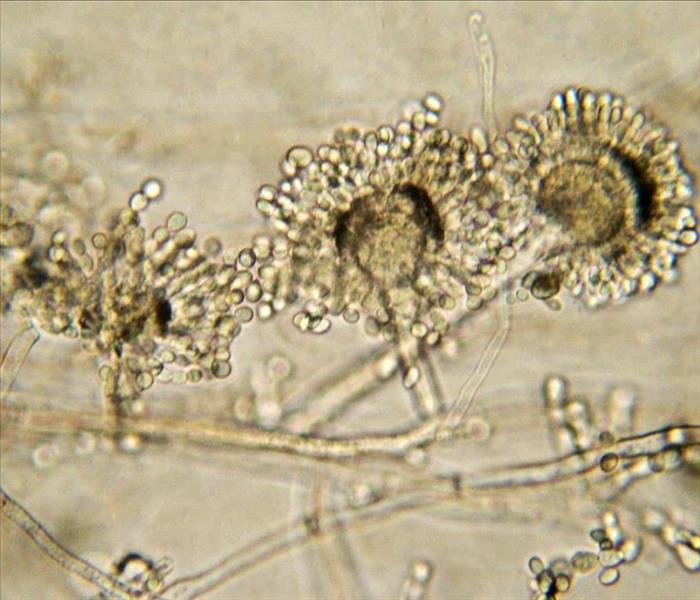 microscopic view of mold spores